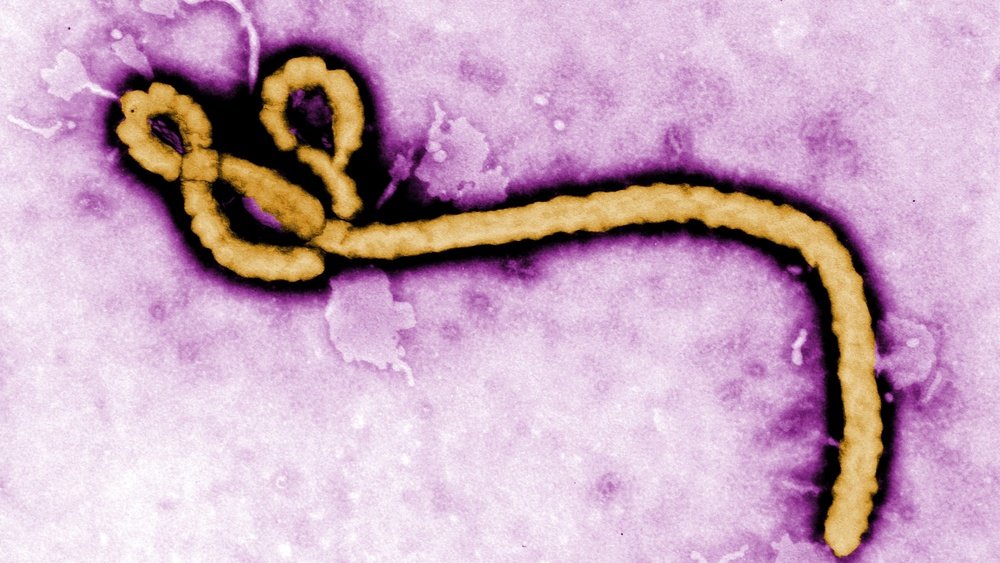What is Ebola -Ai